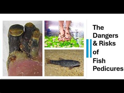 The Dangers & Risks of Fish Pedicures .